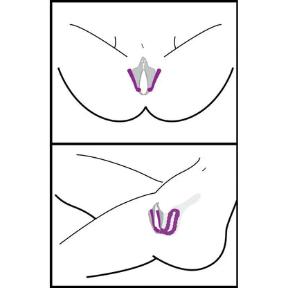 Oral Enhancing Hands Free Labia Spreader Easy Clit Access Clit Isolation  Medical