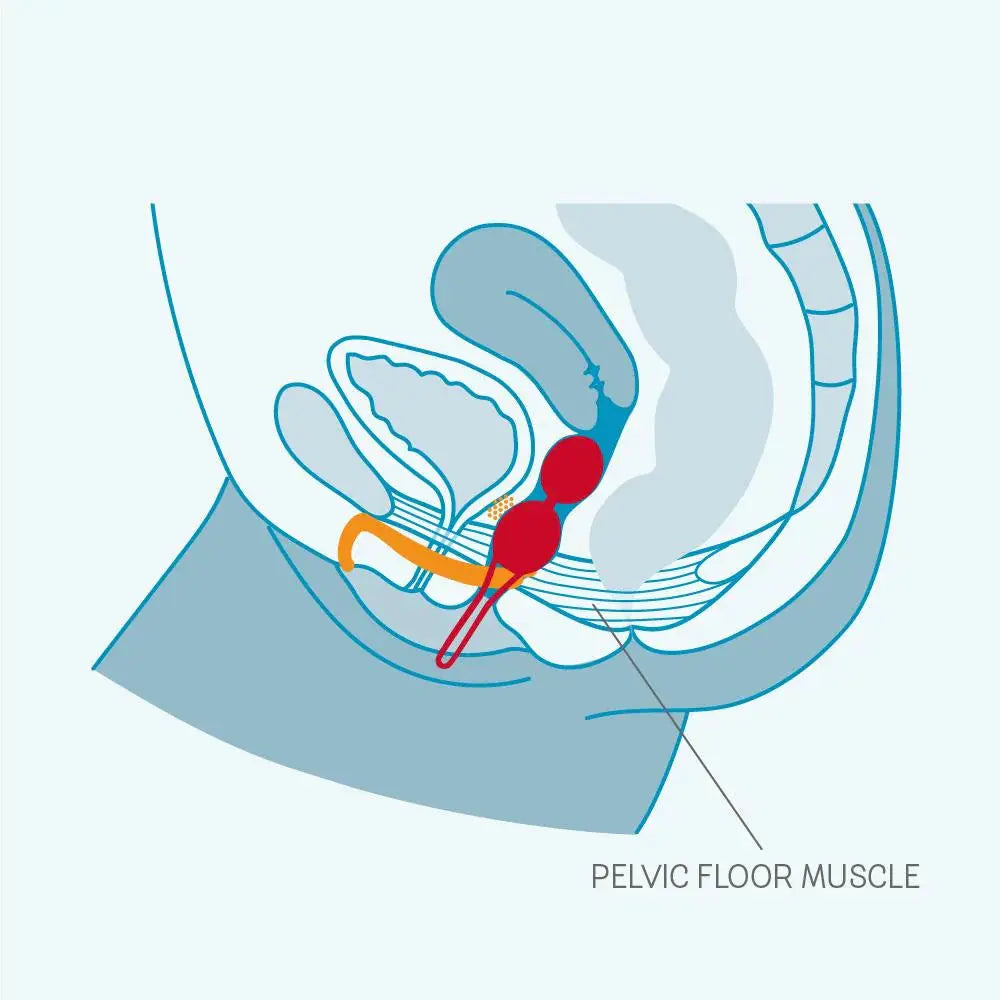 SMARTBALLS DUO Orgasm Training Kegel Exercise Pelvic Floor Bladder Leaks  Kegel Exercise